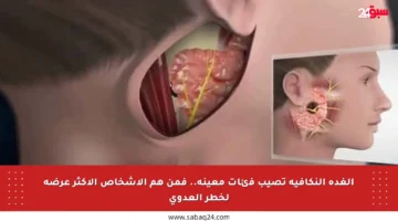 الغدة النكافية تصيب فئات معينة.. فمن هم الأشخاص الأكثر عرضة لخطر العدوى